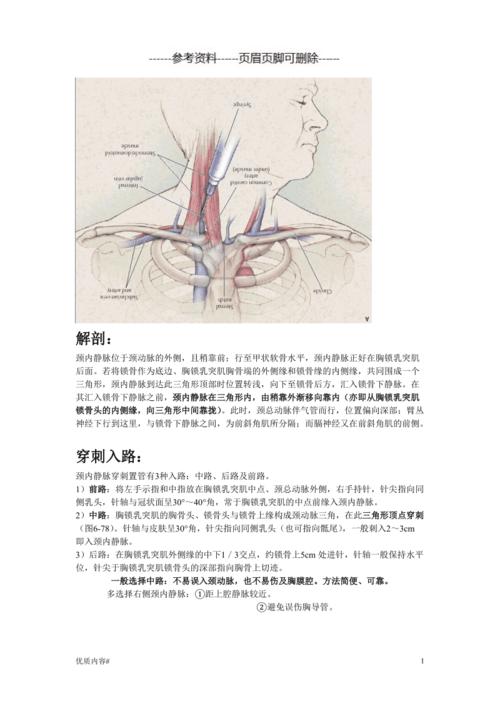 颈内静脉穿刺#严选材料