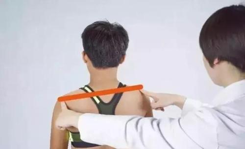 孩子身体脊柱正不正家长要会的几个检查方法