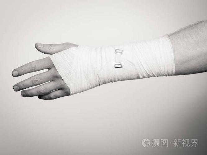 骨折与脱位的概念.在白色绷带的男性手.