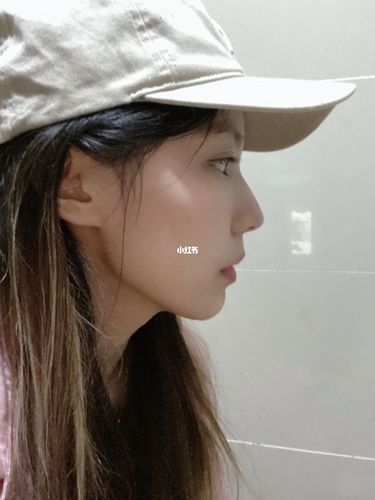 对侧脸的执着_侧脸_摄影_牙齿矫正_做个侧脸女神_美妆