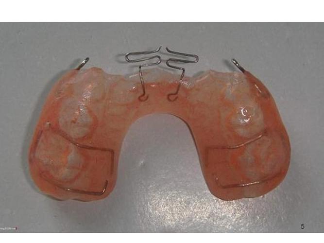 (参考课件)正畸活动矫治器图谱.ppt