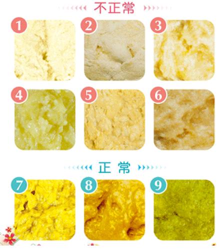 大便系列图片将能让你清楚地分辨,随着新生儿的成长,不管是母乳喂养