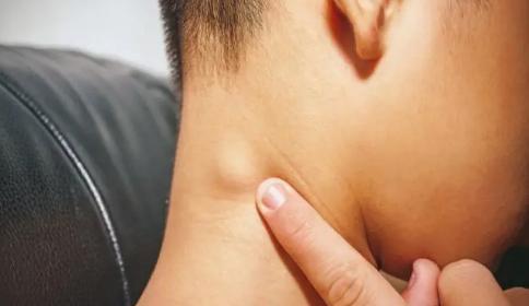 什么样的淋巴结需要重视警惕呢?今天我们就一起来聊一聊.