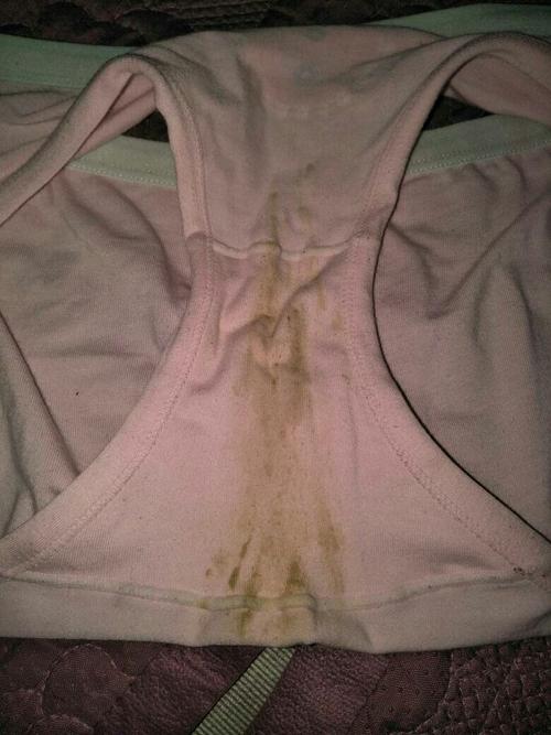 七岁女儿每天换内裤上黄色,必须一天一换内裤,不知是怎么回事?