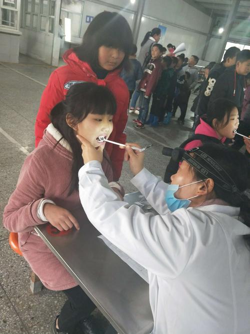 看!我的牙齿白吗?