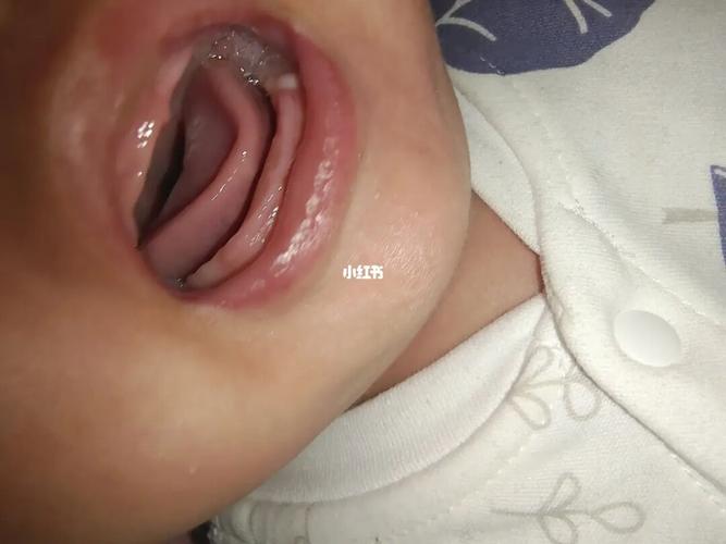 宝宝牙龈上_育儿经验_母婴_母婴_育儿经验