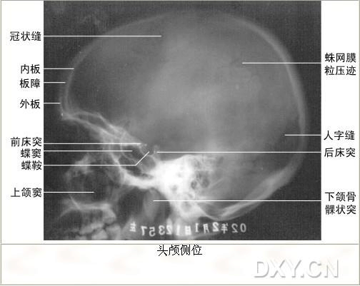 正常头颅x线解剖——头颅平片侧位