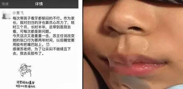 4张图,告诉你张嘴睡觉的孩子面貌会如何变化,中了的要