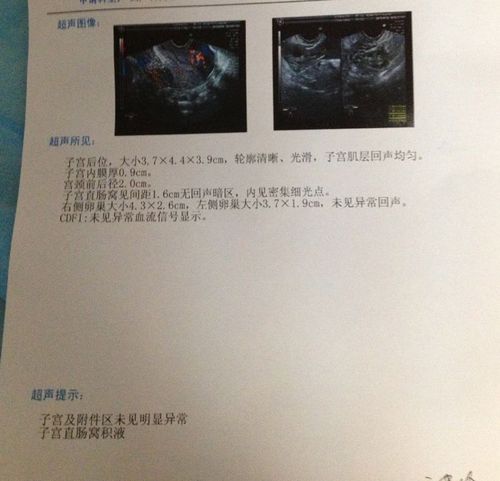 试纸是阴性,彩超子宫无异常,卵巢无回声,可是血检怀孕