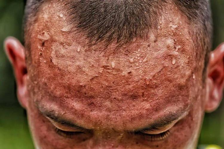 看到儿子的额头,妈妈哽咽着说不出话来