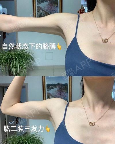 蝴蝶袖拜拜肉不只是胖女孩的困扰,瘦女孩也常有,但是减起来却很难.