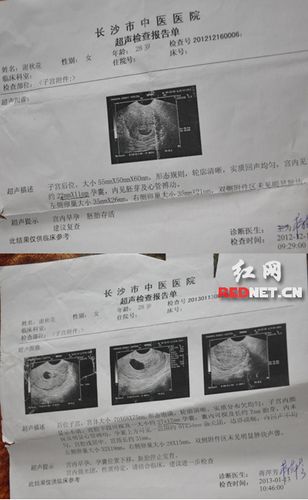 (谢秋花在长沙市中医医院两次人流手术前b超检查均显示宫内早孕,第二
