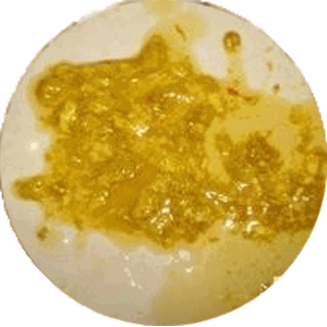 16种婴幼儿异常大便的判断方法看完你肯定会收藏的