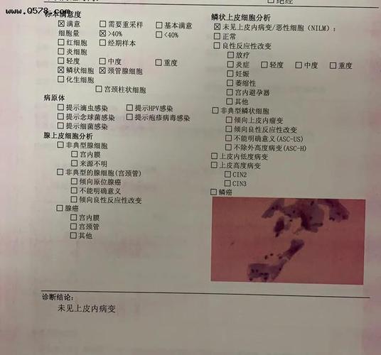这是正常的tct结果.