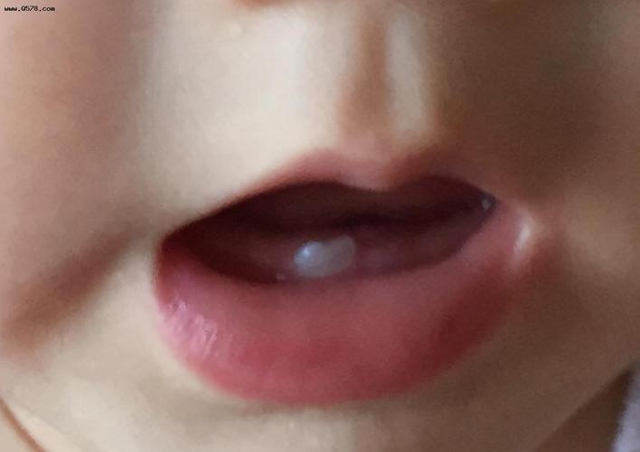 9个月宝宝没长牙宝妈被问责宝宝何时冒牙尖才正常