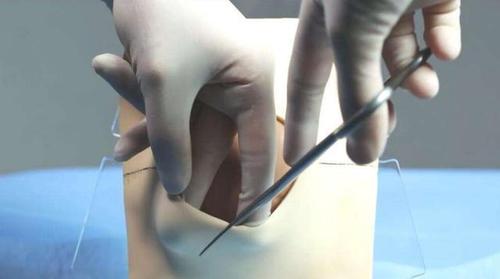 现在生个娃可真费劲25岁产妇顺产侧切却遭婆婆满口嫌弃