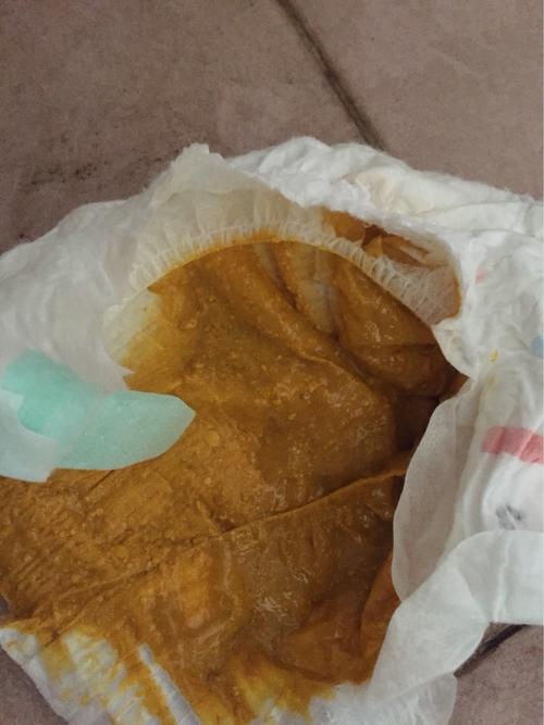 宝宝出生一个月吃母乳的,最近两天才拉一次屎,屎如下图正常吗?