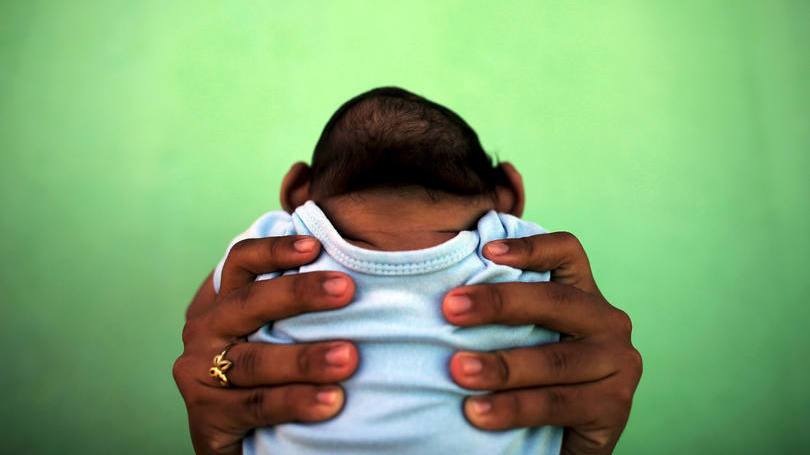 巴西新生儿小头症确诊数突破800例(图)