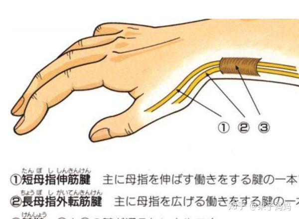 一文教你妈妈手腱鞘炎怎么办