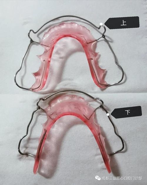 常见保持器的种类