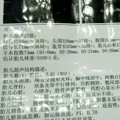 您好,请问孕38周羊水73mm,是不是偏少,怎麼样才能补羊水?
