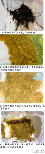 图示:正常的宝宝大便什么样