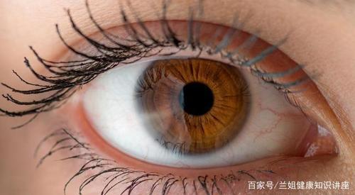 1,出现眼周角膜老年环01血脂高不高,眼睛先知道?血脂升高眼睛会受