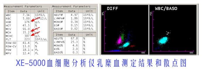 [转载]乳糜血与脂血在血常规检测上不同影响分析