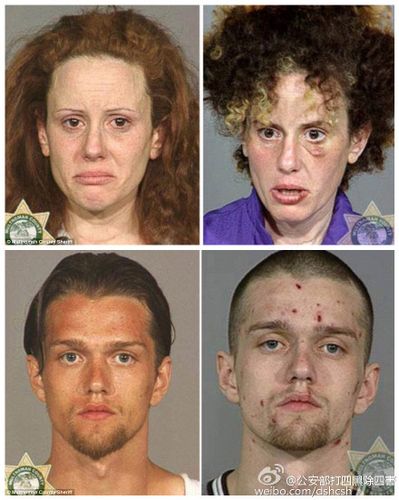 毒品到底多可怕震撼吸毒前后恐怖对比照7