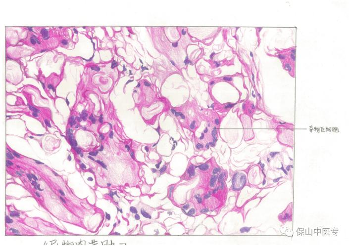 保山中医专学生在全国第一届病理绘图大赛中创佳绩