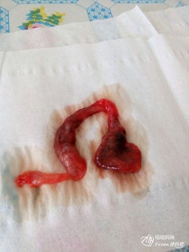 这是流掉的宝宝吗?胆小者勿近!