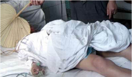 旅馆内做变性手术 "网友"主刀男子睾丸被切失去性功能