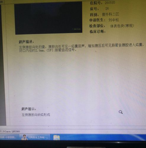 超声检查结果如图所示!