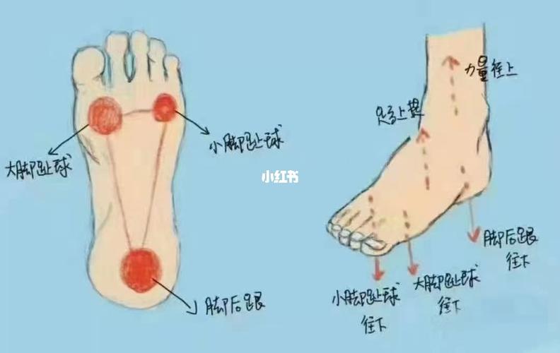 你的脚底板痛吗跑者的足底筋膜炎如何治疗