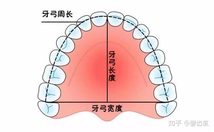 有的牙弓偏尖,有的牙弓偏方,这些都不是标准牙弓,甚至会影响牙齿排列