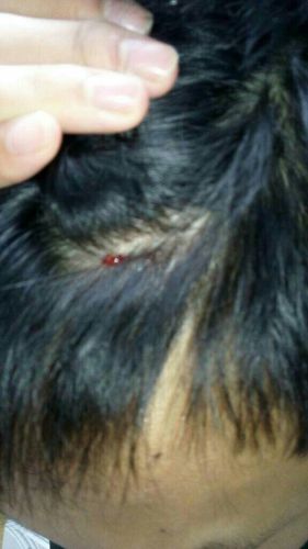 头被抽油烟机撞了,出血了,有没有问题,需要怎么处理