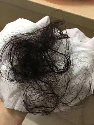 90后和80后宝妈脱发严重怎么办?有什么洗发水可以解决产后孕妇脱发