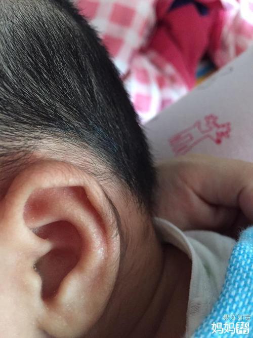 宝宝耳朵上的毛好长啊