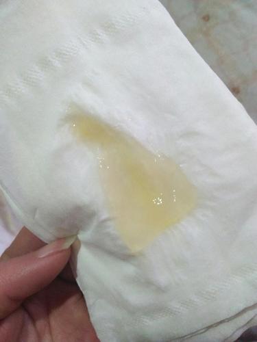 求救,这是不是要生了呀?