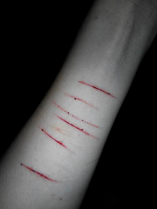 今天看看自己的手上伤疤, 这些都是以前为了感情做的
