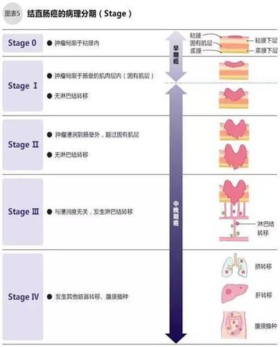 首先根据结直肠癌的分期选择标准治疗,标准治疗包括内窥镜治疗,手术