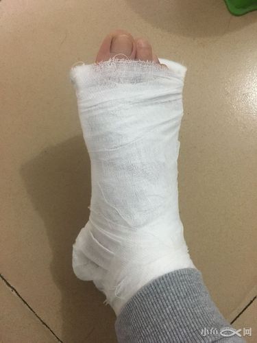 中医院,什么水平,扭了一下脚1000大洋没了_鹭岛生活