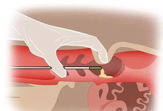 牛人工授精全套详解来啦附图文