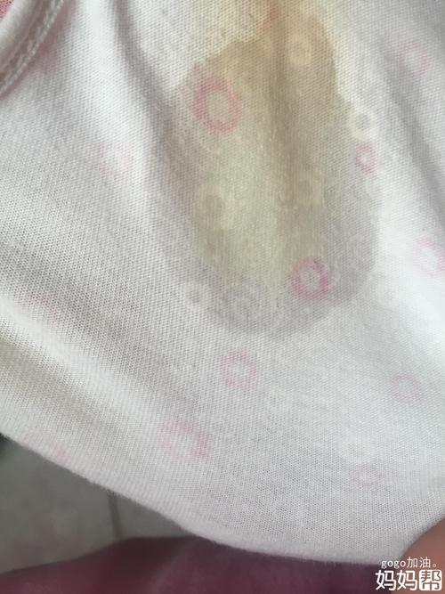 这是孕晚期分泌物增多还是破水呢?