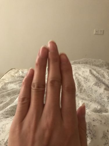 双手中指和无名指都不能合拢,缝隙非常大,而且是天生的,和我爸爸的