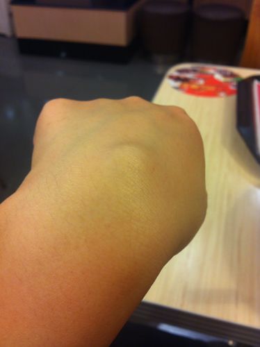 手背上长了一个大包,像骨头凸出来的感觉,按下去有点硬,也不疼不痒的