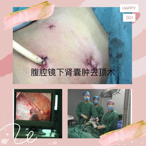 吉水县人民医院泌尿外科微创手术治疗