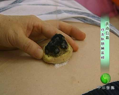 [中华医药]洪涛信箱:巧灸肚脐解尿频(2009.10.07) 中华医药 cct.