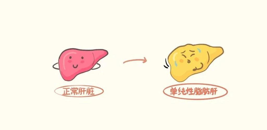 腹部b超: b超报告一般都会在下方的超声提示中,写明是否有「脂肪肝」