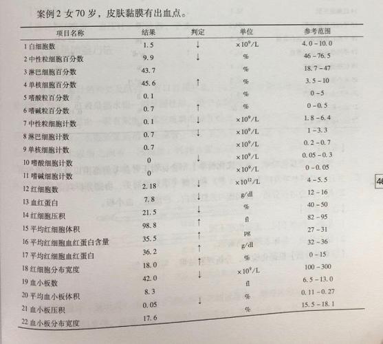 血常规化验单怎么看?